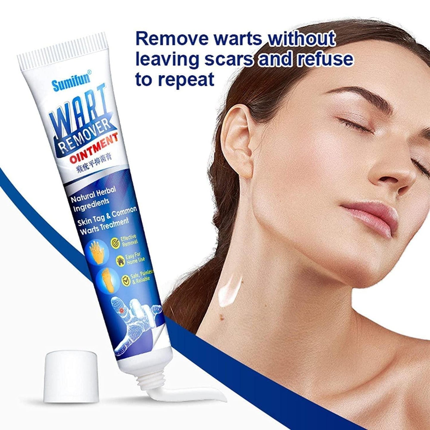 💆Wart Remover Ointment for All Skin Types 💥Buy 1 Get 1 Free 💥