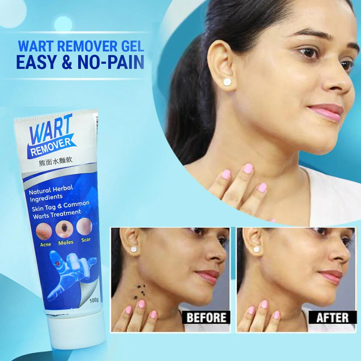 💆Wart Remover Ointment for All Skin Types 💥Buy 1 Get 1 Free 💥